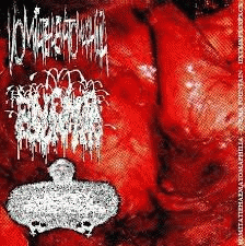 Urinary Tract Infection From Severe Pus Clots : Vomitatiehaematomaphilia - Enema Fountain - Urinary Tract Infection from Severe Pus Clots